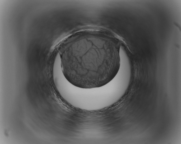 X0000099471448200806061208