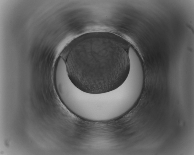 X0000099471472200806061208