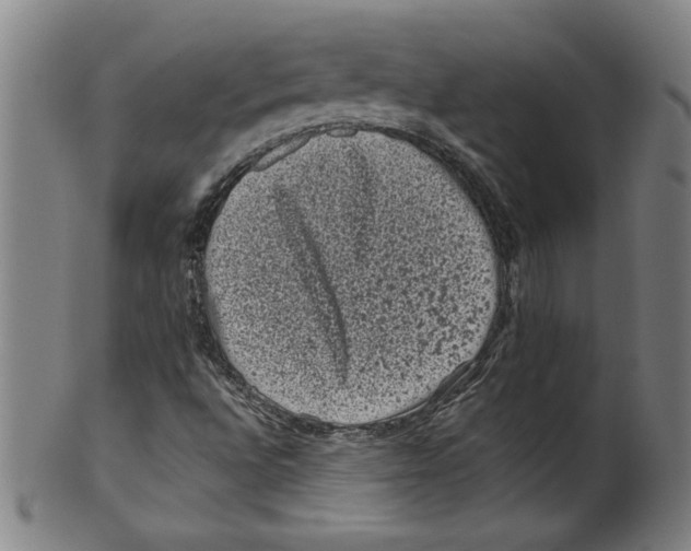 X0000099471496200806061207