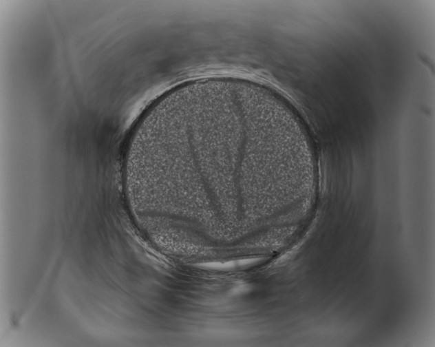 X0000099471501200806061207