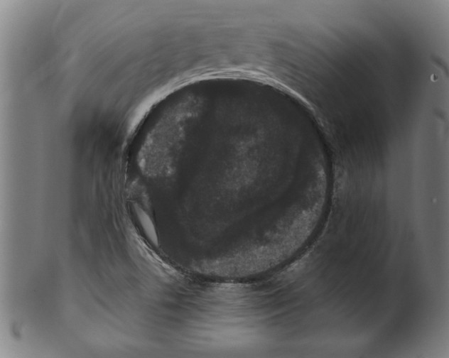 X0000099471506200806061207