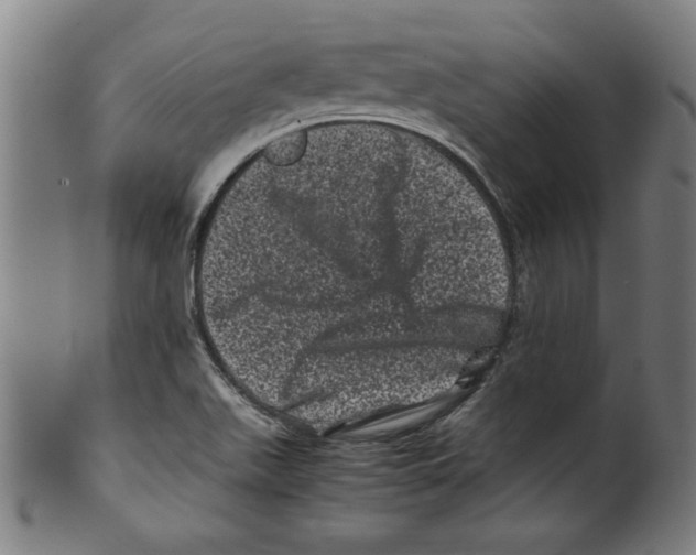 X0000099471511200806061207