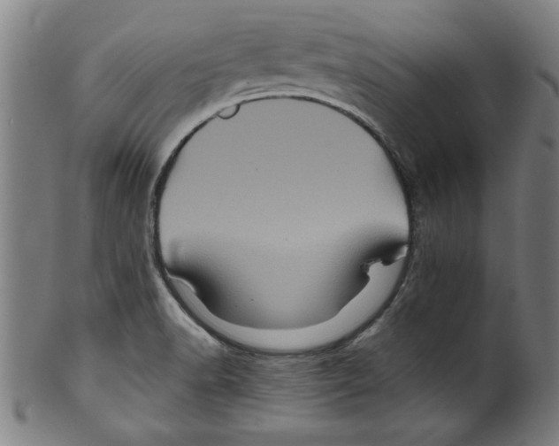 X0000099471518200806061207