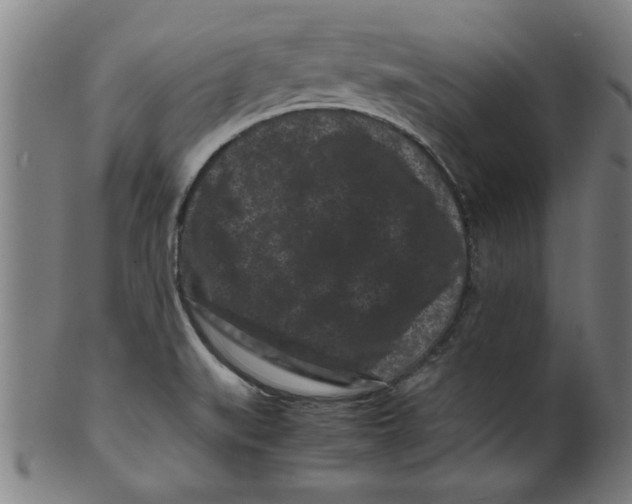 X0000099471519200806061207