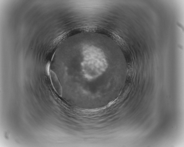 X0000099480047200805091618