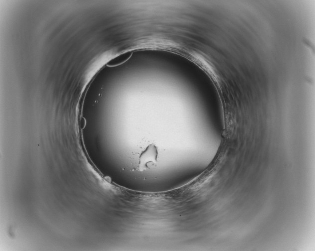 X0000099481103200805091603