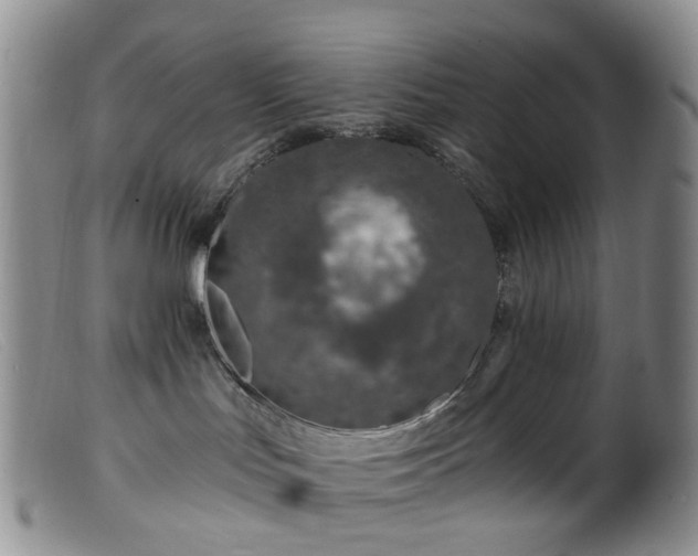 X0000099480047200805161145