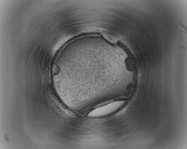 X0000099480877200805161132