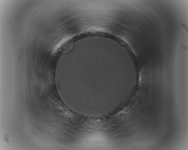 X0000099480919200805161131