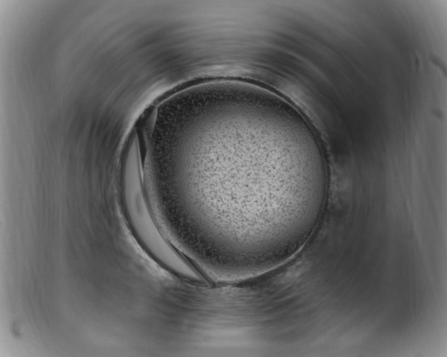 X0000099480992200805161130