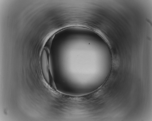 X0000099481004200805161130