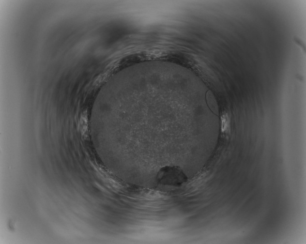 X0000099481011200805161130