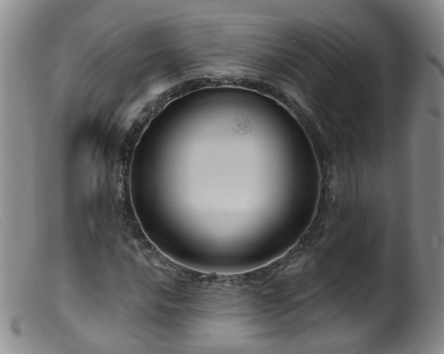 X0000099481016200805161130