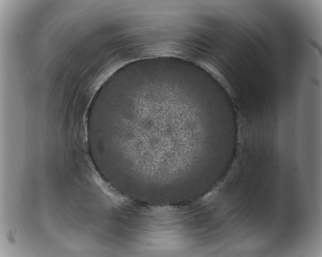 X0000099481031200805161130