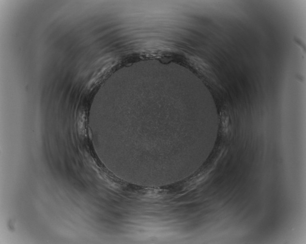 X0000099481060200805161129