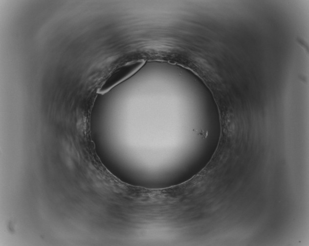 X0000099481061200805161129