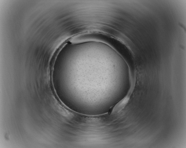 X0000099481076200805161129