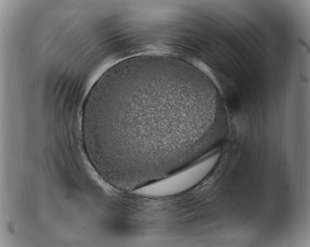 X0000099481099200805161129