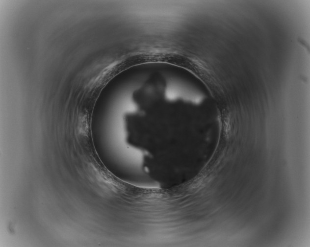 X0000099481204200805161126
