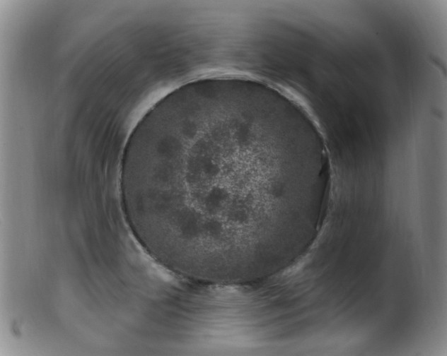 X0000099481231200805161127