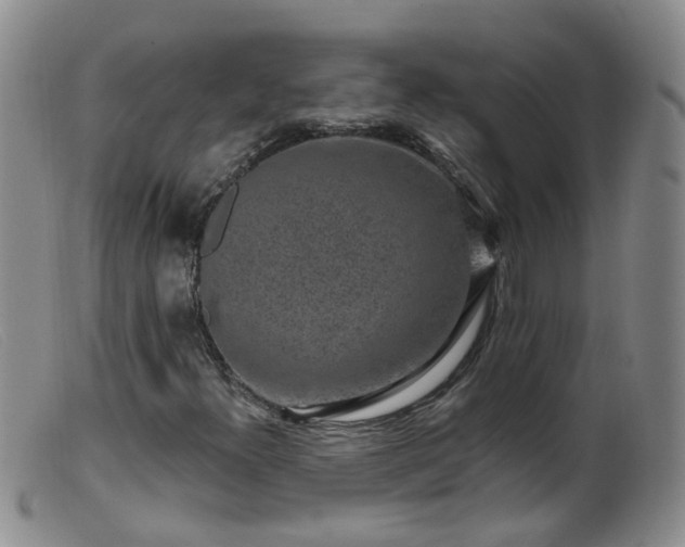 X0000099481300200805161125