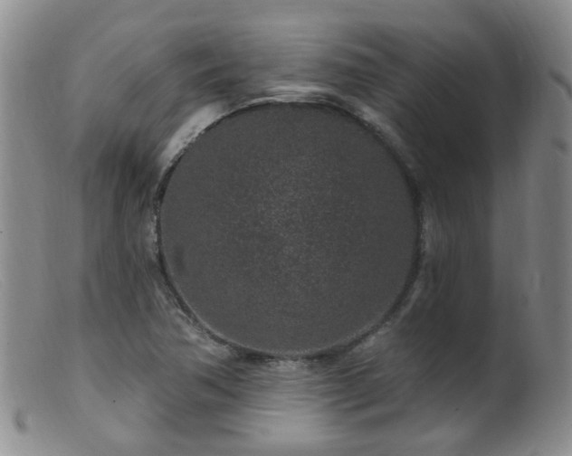 X0000099481362200805161125