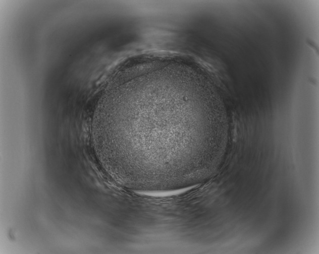 X0000099481397200805161123
