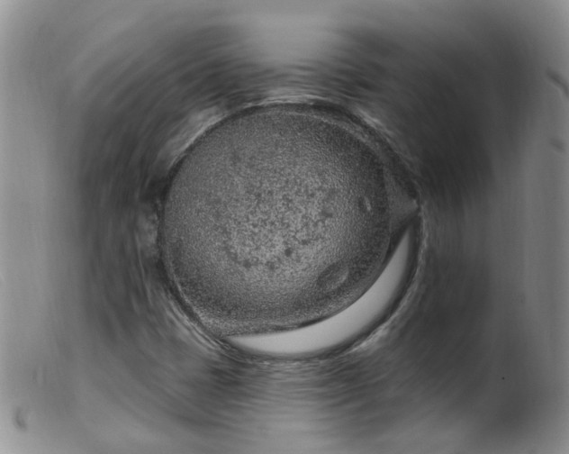 X0000099481401200805161123