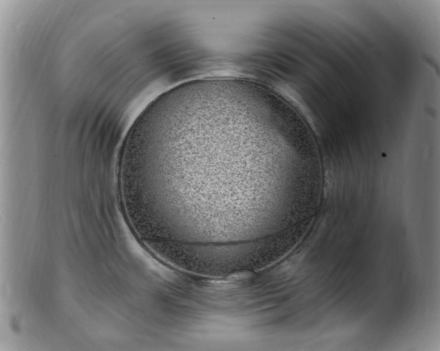 X0000099481483200805161123
