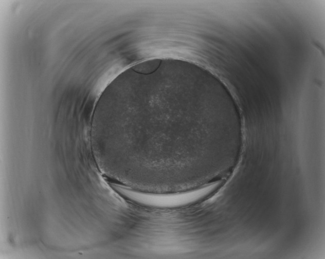 X0000099481529200805161123
