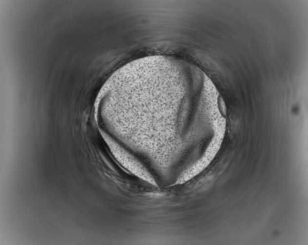 X0000099481010200805301614