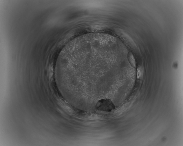 X0000099481011200805301614