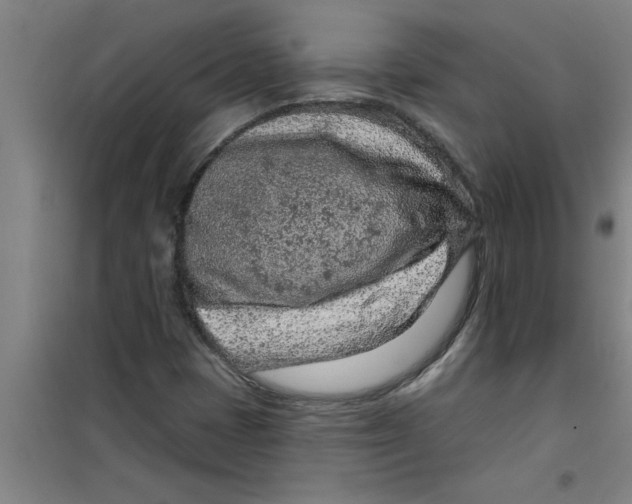 X0000099481401200805301608