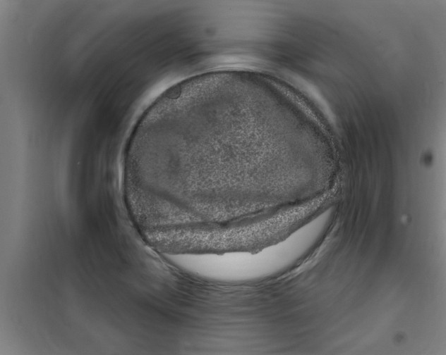 X0000099481419200805301609