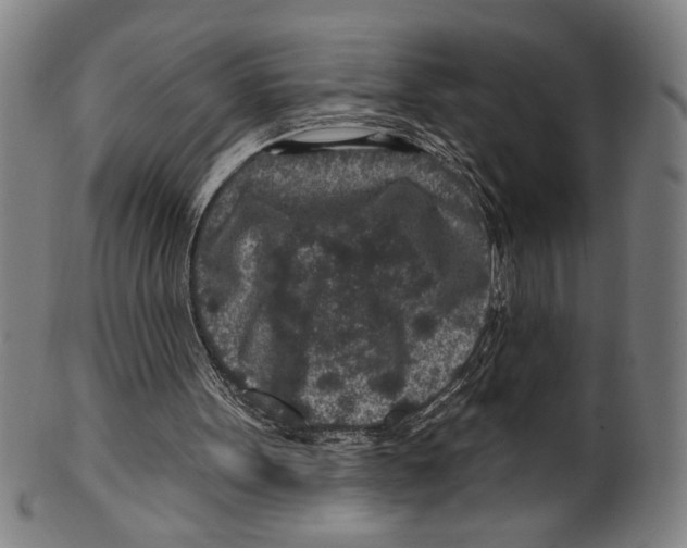 X0000099480099200806061255