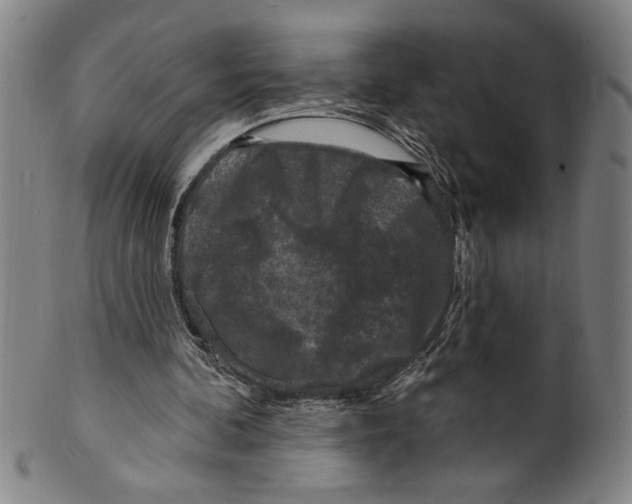 X0000099480292200806061252