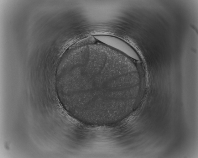 X0000099480385200806061250