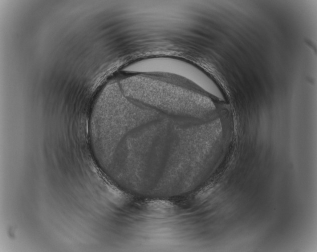 X0000099480397200806061250