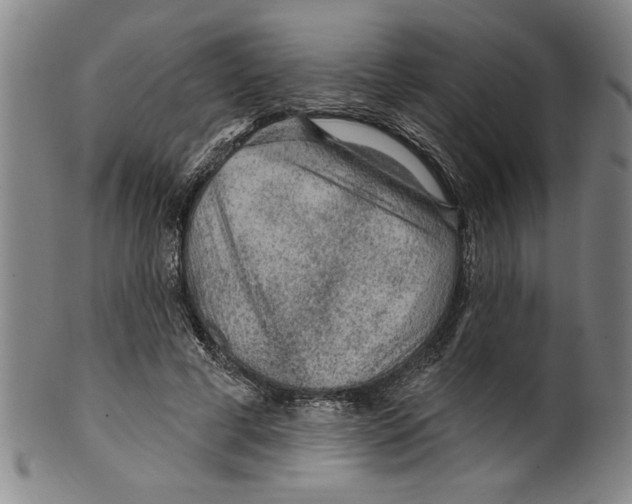 X0000099480593200806061247