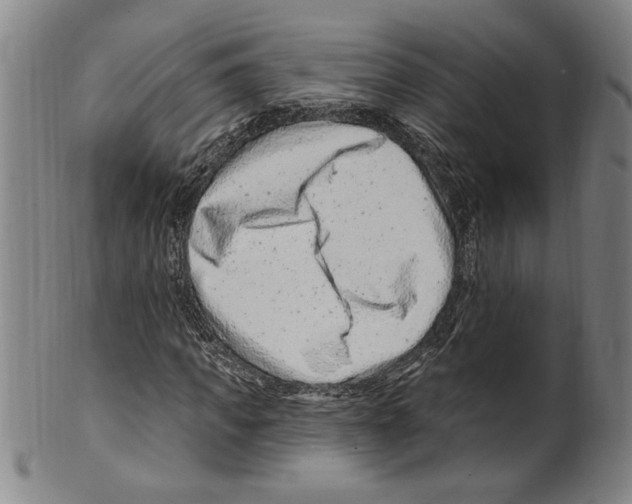 X0000099480917200806061241