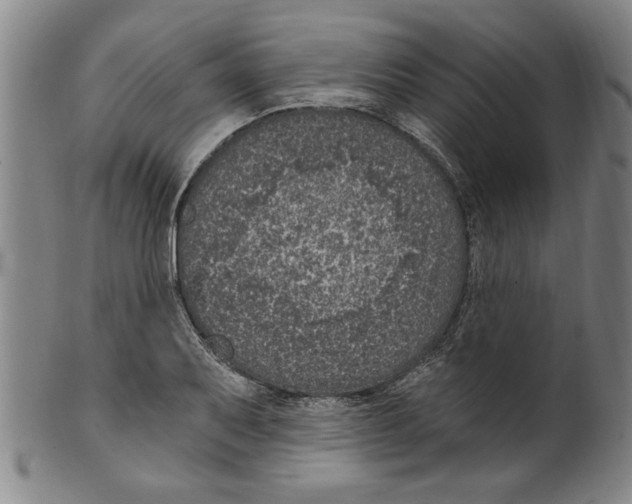 X0000099481079200806061239