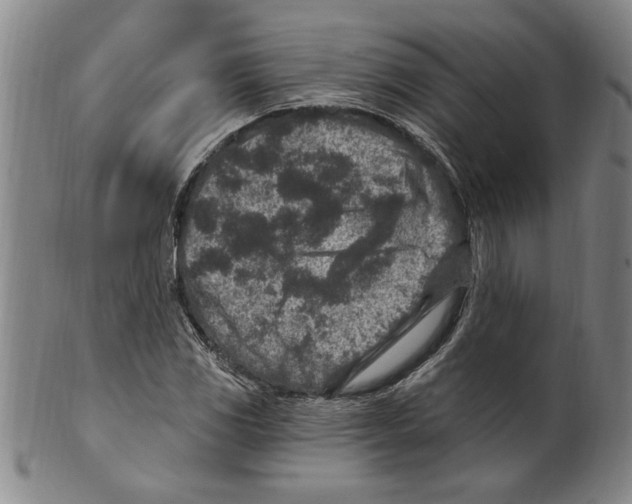 X0000099481117200806061238