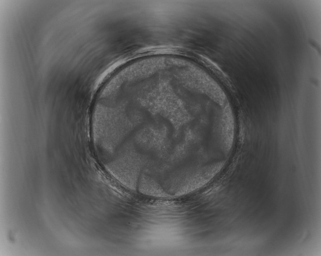 X0000099481174200806061238