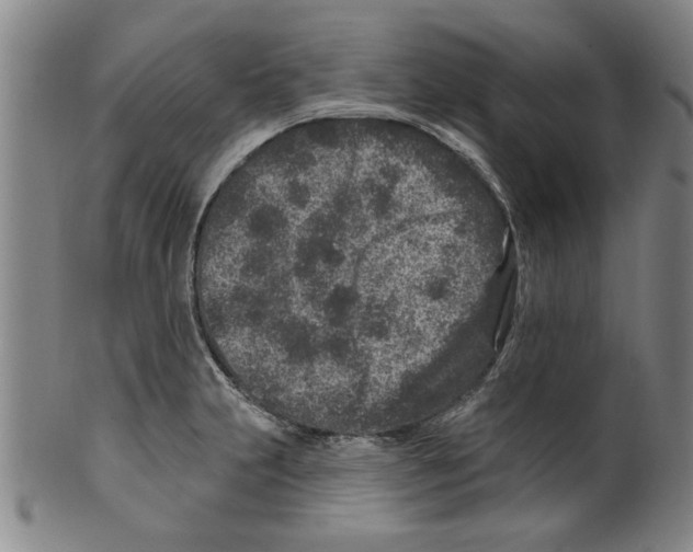 X0000099481231200806061237