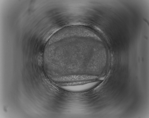 X0000099481361200806061235