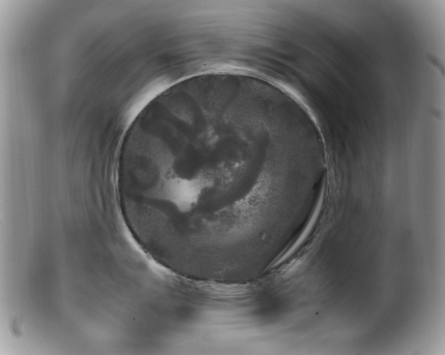 X0000099491007200805151402