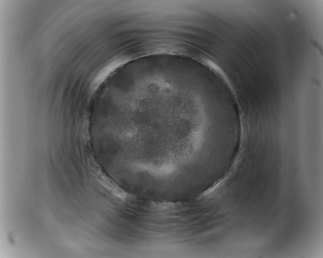 X0000099491019200805151401