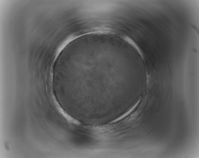 X0000099491099200805151401
