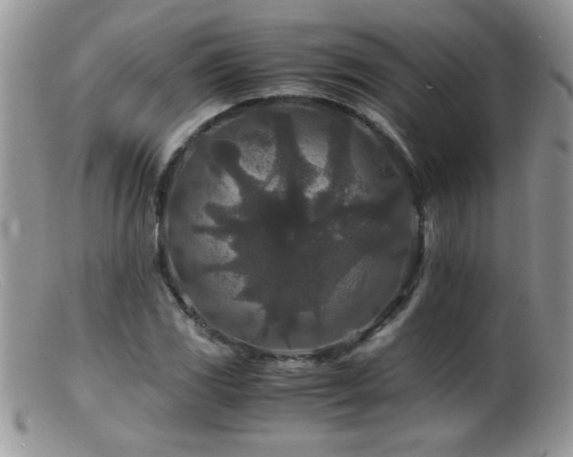 X0000099491117200805151400