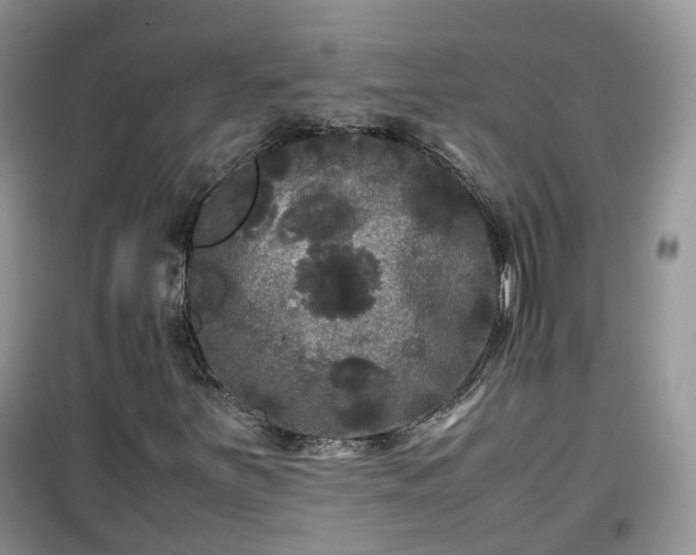 X0000099491251200805221330